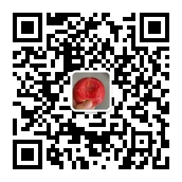 wechat:看见另一种可能